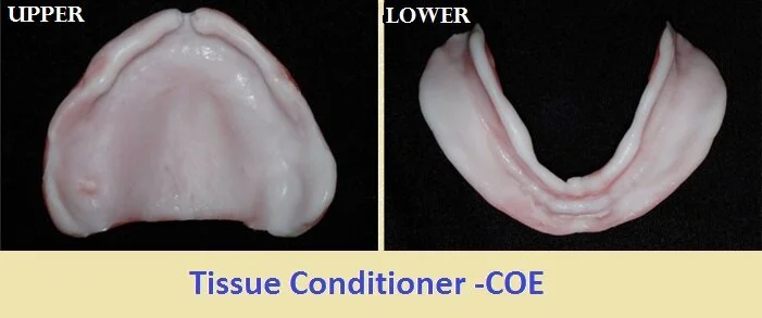 Coe-Comfort tissue conditioner treatment